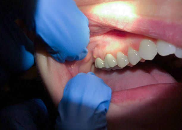 Best Urgent Dental Care for Toothaches in La Luz, NM