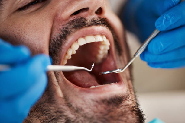 Best Emergency Dental Care for Sports Injuries in La Luz, NM
